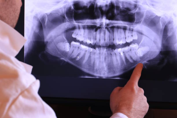 Best Emergency Root Canal Treatment in Perryman, MD