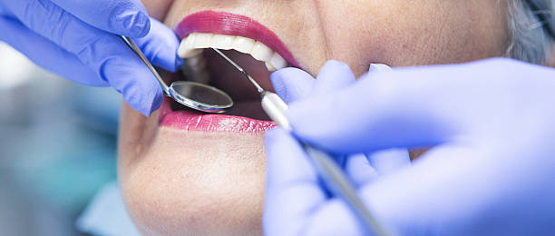 Best Emergency Treatment for Dental Infections or Abscesses in Perryman, MD