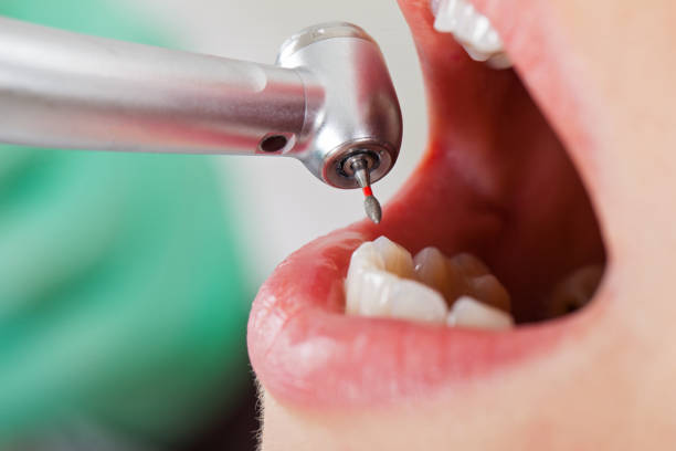 Best Same-Day Emergency Dental Services in Perryman, MD